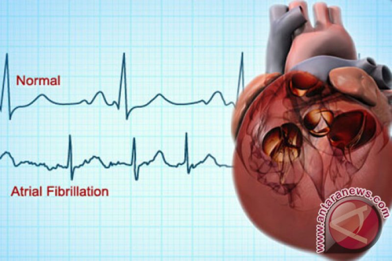 Dokter: Skrining untuk Deteksi Risiko Kelainan Jantung Saat Olahraga 