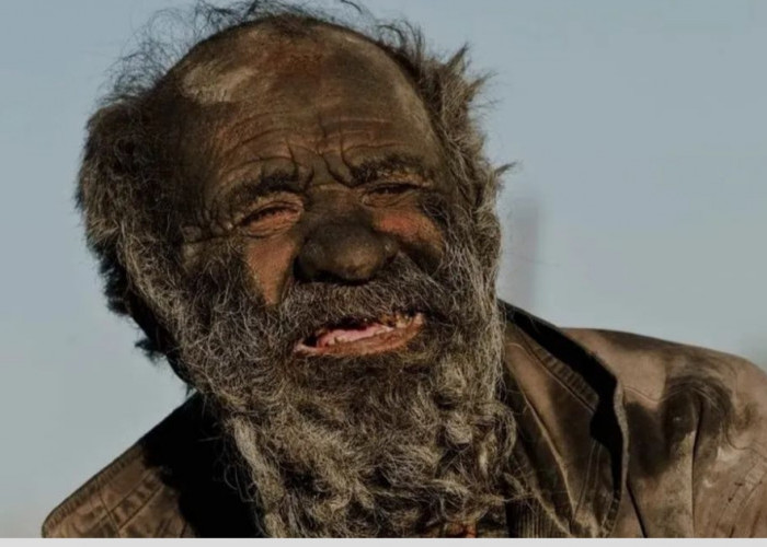 Pria Terkotor di Dunia, Amou Haji Meninggal Usai Dimandikan, 50 Tahun Lebih Tak Mandi