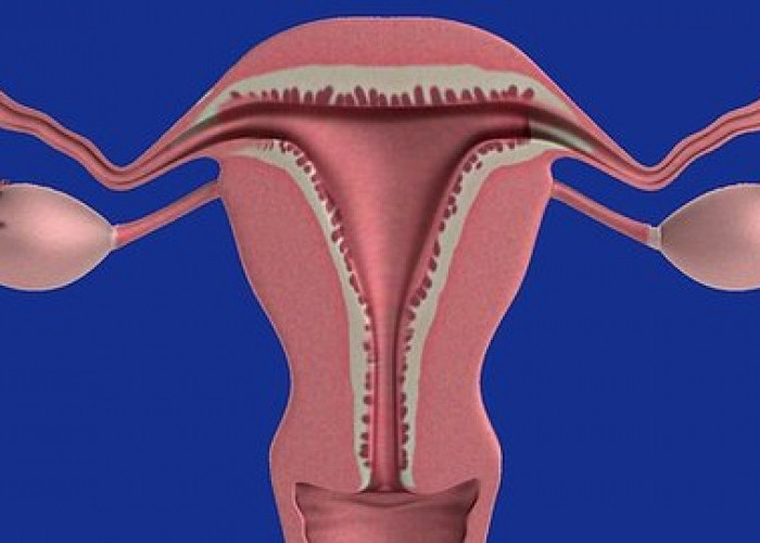 Dokter: Kanker Serviks jadi Penyebab Utama Kematian pada Wanita