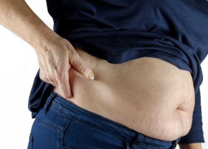 Wamenkes: Obesitas Tingkatkan Risiko Diabetes hingga Komplikasi Mematikan
