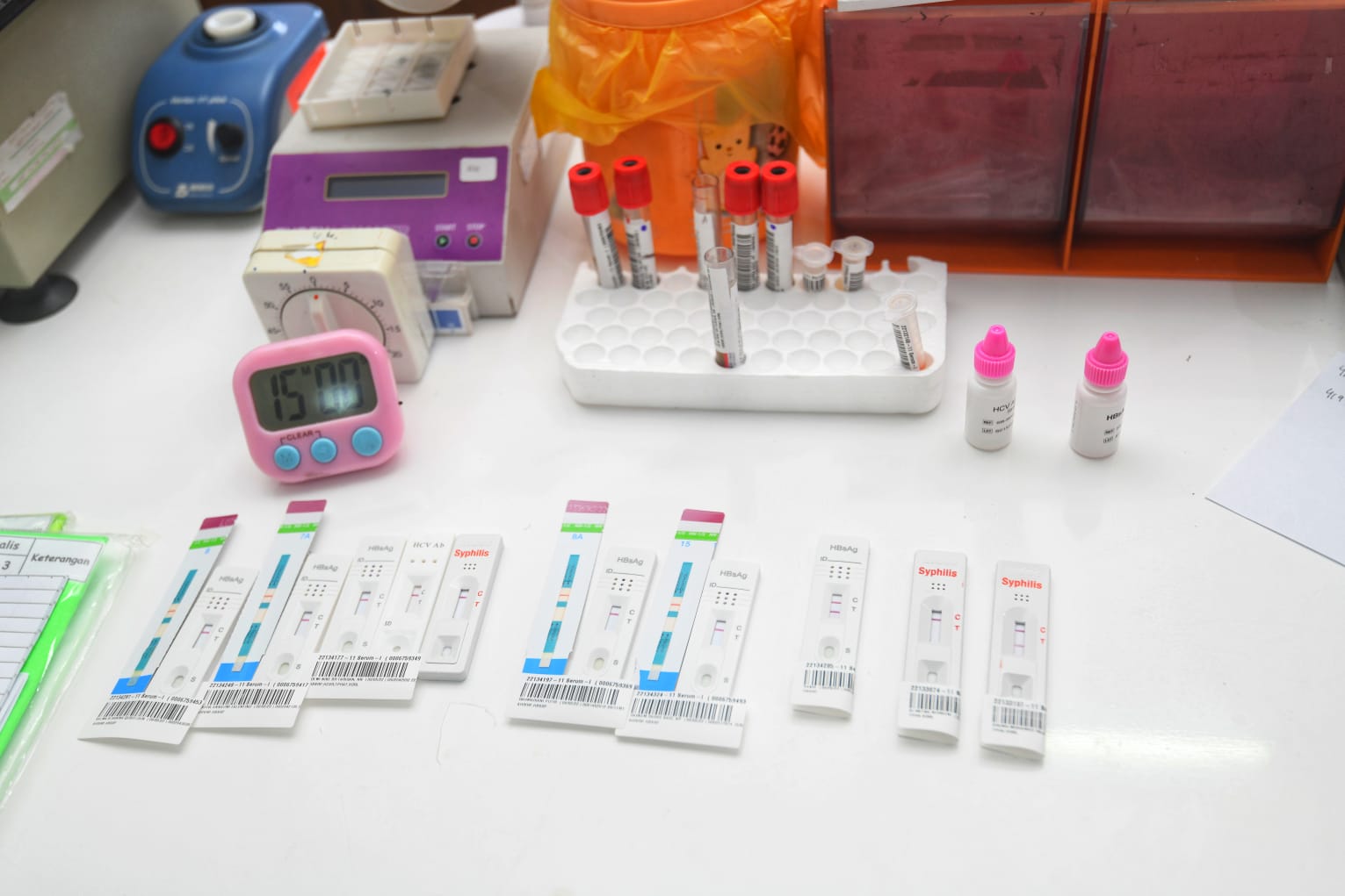 Antisipasi Hepatitis Akut di Jabar, Ridwan Kamil: Jangan Panik, Negara Siap Atasi